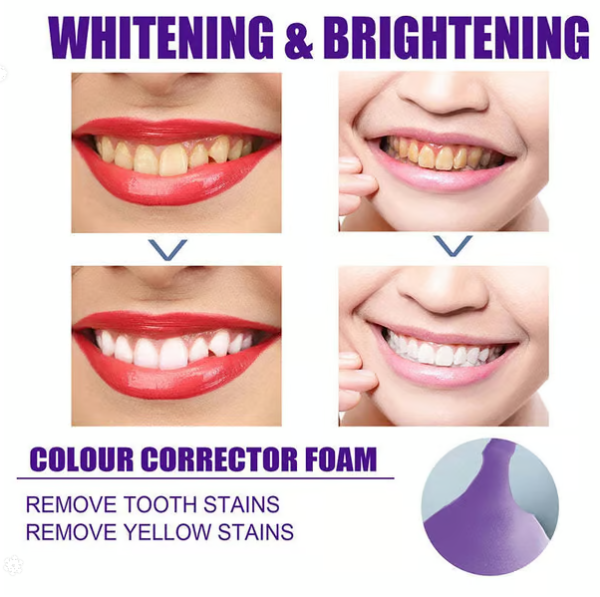 ๐จ Clearance Blowout Sale! ๐จ Seurico Herbal Whitening Mousse Toothpaste