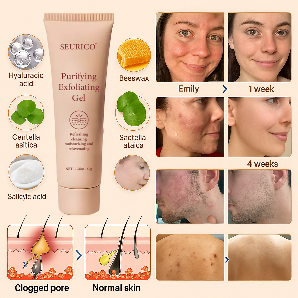 Seurico™ Exfoliating Gel for Clear, Smooth Skin