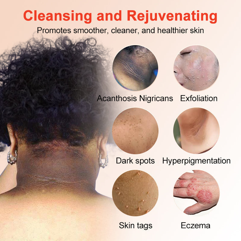 Seurico™ Exfoliating Gel for Clear, Smooth Skin