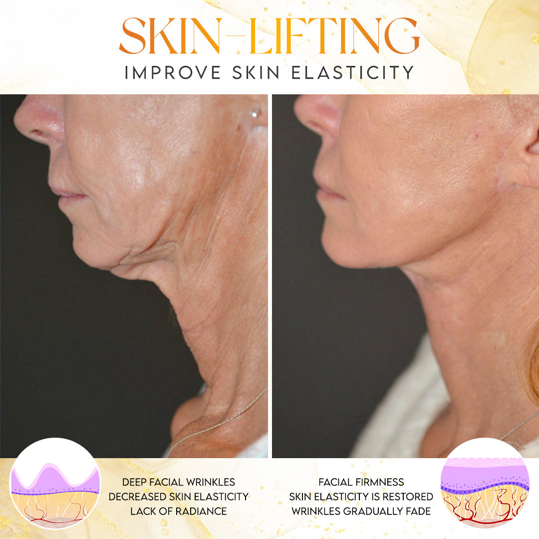 š§“ Odeiun⢠Botox Bee Venom Firming Stick ā Visibly Tighten, Lift & Smooth Skin in Just 7 Days