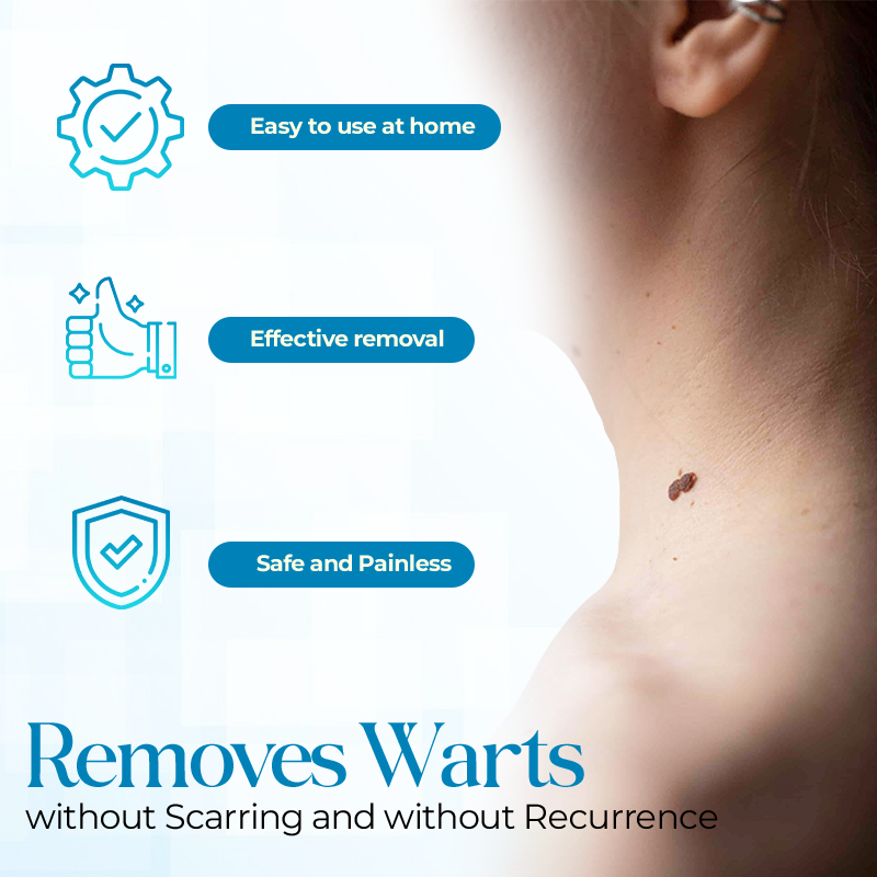 Seurico PapiClear Skin Tag & Wart Cream