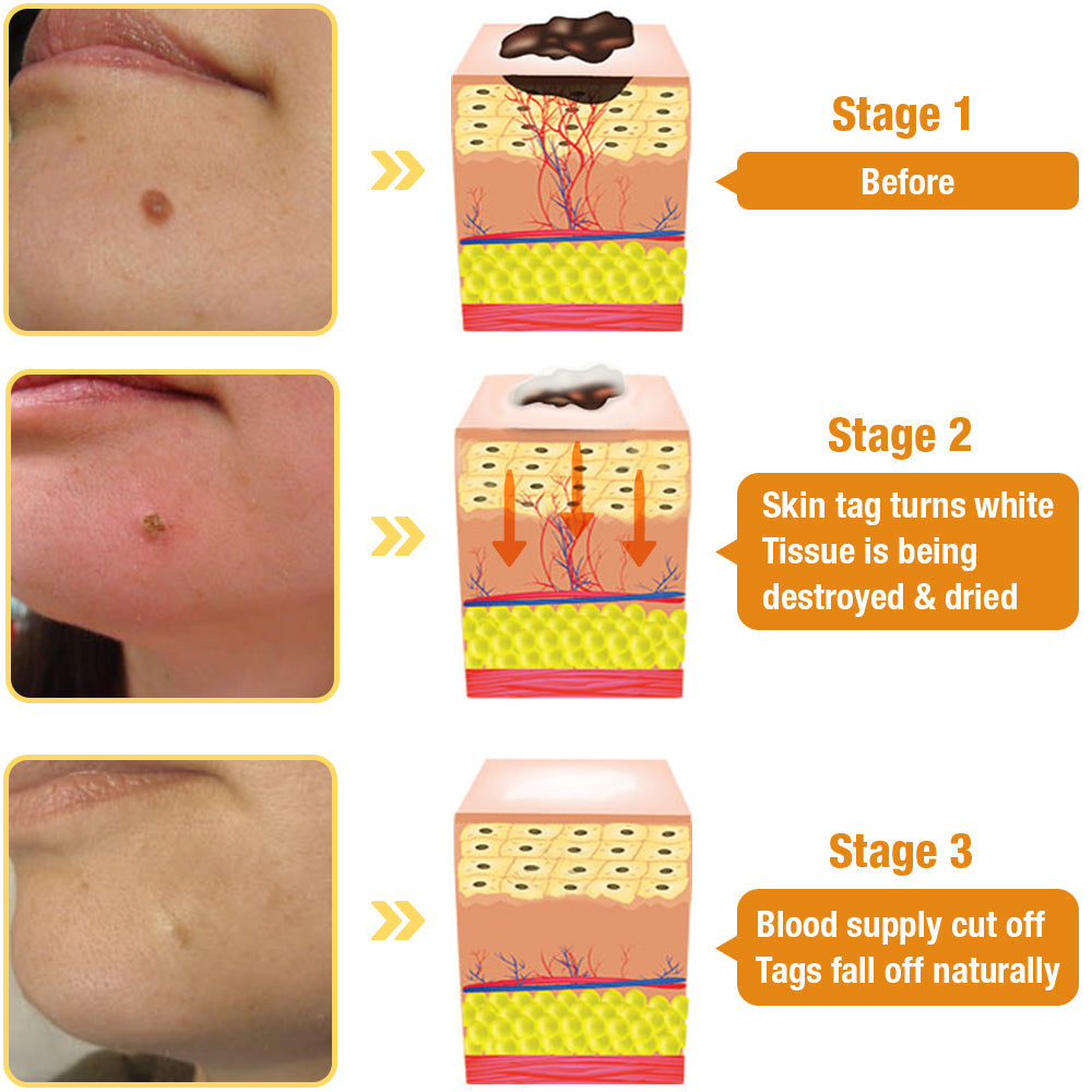 TagRecede Honeybee Venom Spray