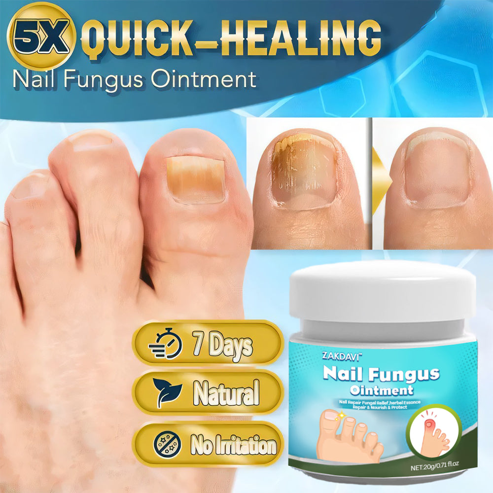 5X Quick-healing Nail Fungus Ointment