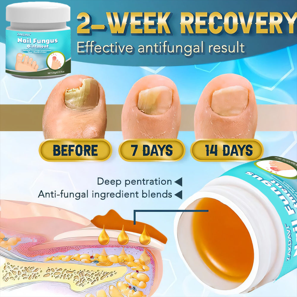 5X Quick-healing Nail Fungus Ointment