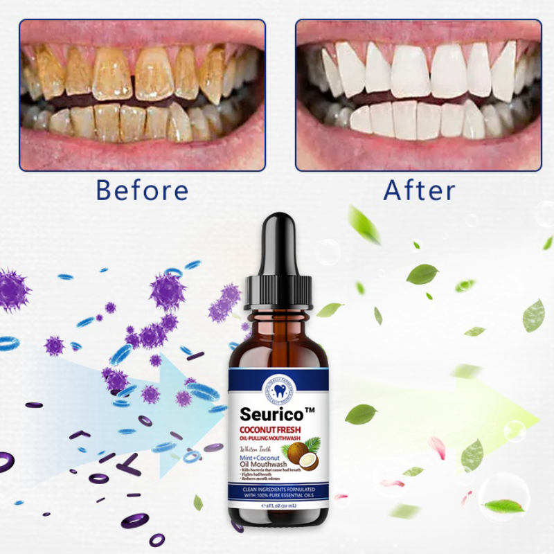 🎄 Holiday Sale Extravaganza: Enjoy 50% Off! 🎁 Coconut Oil-Pulling Mouthwash