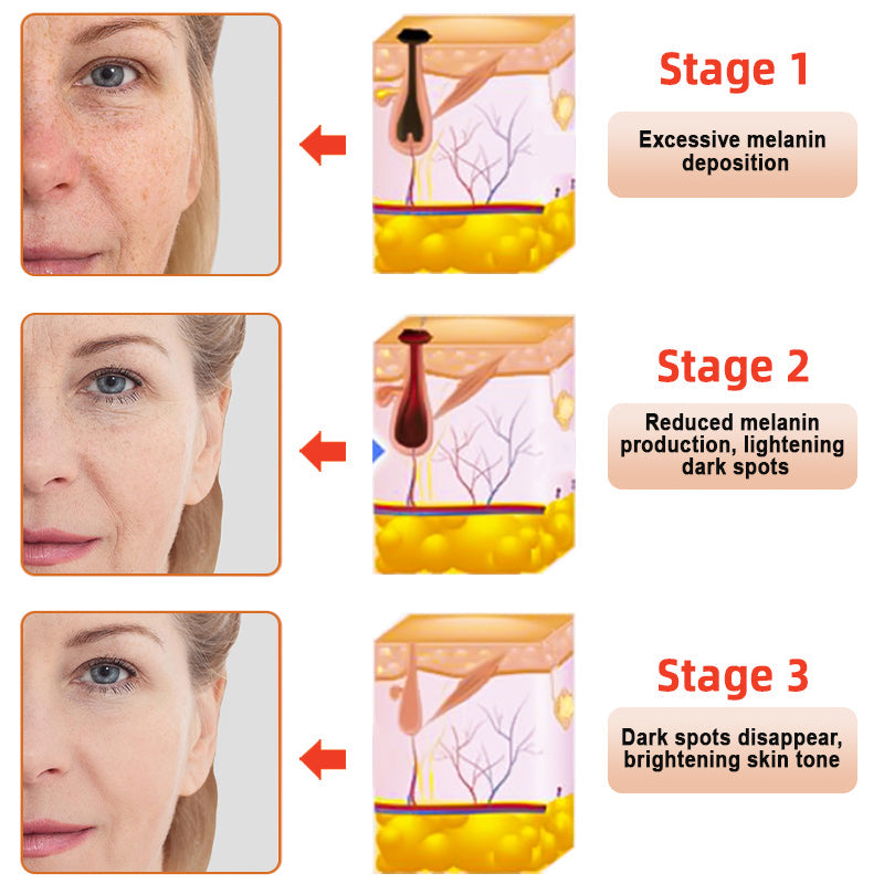Seurico™ Exfoliating Gel for Clear, Smooth Skin