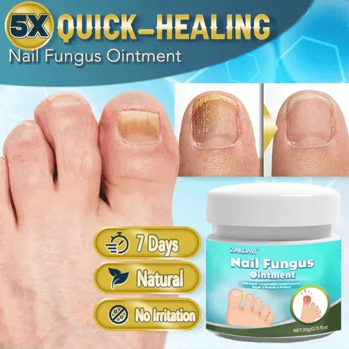 5X Quick-healing Nail Fungus Ointment