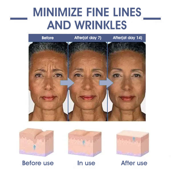 🩵𝐋𝐚𝐬𝐭 𝐃𝐚𝐲 𝐃𝐢𝐬𝐜𝐨𝐮𝐧𝐭: 𝟖𝟕% 𝐎𝐅𝐅🌸𝗝𝗘𝗥𝗘𝗠𝗬𝗧𝗜𝗦™ 𝐀𝐝𝐯𝐚𝐧𝐜𝐞𝐝 𝐅𝐢𝐫𝐦𝐢𝐧𝐠 & 𝐖𝐫𝐢𝐧𝐤𝐥𝐞-𝐑𝐞𝐝𝐮𝐜𝐢𝐧𝐠 𝐂𝐫𝐞𝐚𝐦: 𝗥𝗲𝘀𝘁𝗼𝗿𝗲 𝗦𝗸𝗶𝗻 𝗘𝗹𝗮𝘀𝘁𝗶𝗰𝗶𝘁𝘆⭐