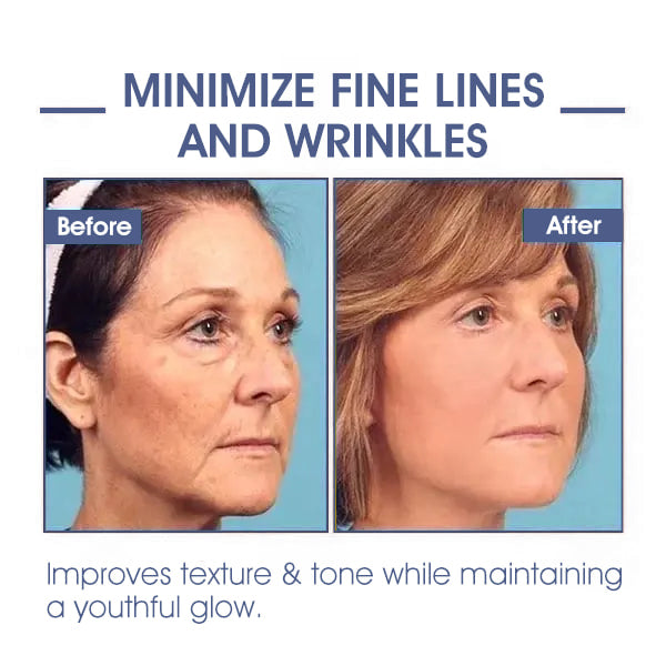 🩵𝐋𝐚𝐬𝐭 𝐃𝐚𝐲 𝐃𝐢𝐬𝐜𝐨𝐮𝐧𝐭: 𝟖𝟕% 𝐎𝐅𝐅🌸𝗝𝗘𝗥𝗘𝗠𝗬𝗧𝗜𝗦™ 𝐀𝐝𝐯𝐚𝐧𝐜𝐞𝐝 𝐅𝐢𝐫𝐦𝐢𝐧𝐠 & 𝐖𝐫𝐢𝐧𝐤𝐥𝐞-𝐑𝐞𝐝𝐮𝐜𝐢𝐧𝐠 𝐂𝐫𝐞𝐚𝐦: 𝗥𝗲𝘀𝘁𝗼𝗿𝗲 𝗦𝗸𝗶𝗻 𝗘𝗹𝗮𝘀𝘁𝗶𝗰𝗶𝘁𝘆⭐
