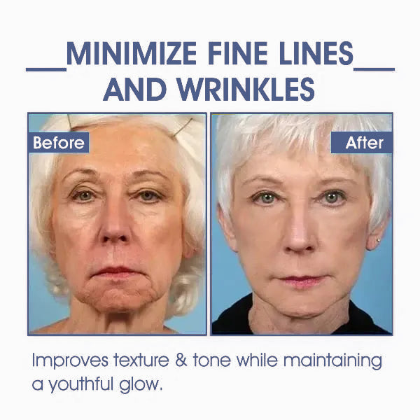 🩵𝐋𝐚𝐬𝐭 𝐃𝐚𝐲 𝐃𝐢𝐬𝐜𝐨𝐮𝐧𝐭: 𝟖𝟕% 𝐎𝐅𝐅🌸𝗝𝗘𝗥𝗘𝗠𝗬𝗧𝗜𝗦™ 𝐀𝐝𝐯𝐚𝐧𝐜𝐞𝐝 𝐅𝐢𝐫𝐦𝐢𝐧𝐠 & 𝐖𝐫𝐢𝐧𝐤𝐥𝐞-𝐑𝐞𝐝𝐮𝐜𝐢𝐧𝐠 𝐂𝐫𝐞𝐚𝐦: 𝗥𝗲𝘀𝘁𝗼𝗿𝗲 𝗦𝗸𝗶𝗻 𝗘𝗹𝗮𝘀𝘁𝗶𝗰𝗶𝘁𝘆⭐