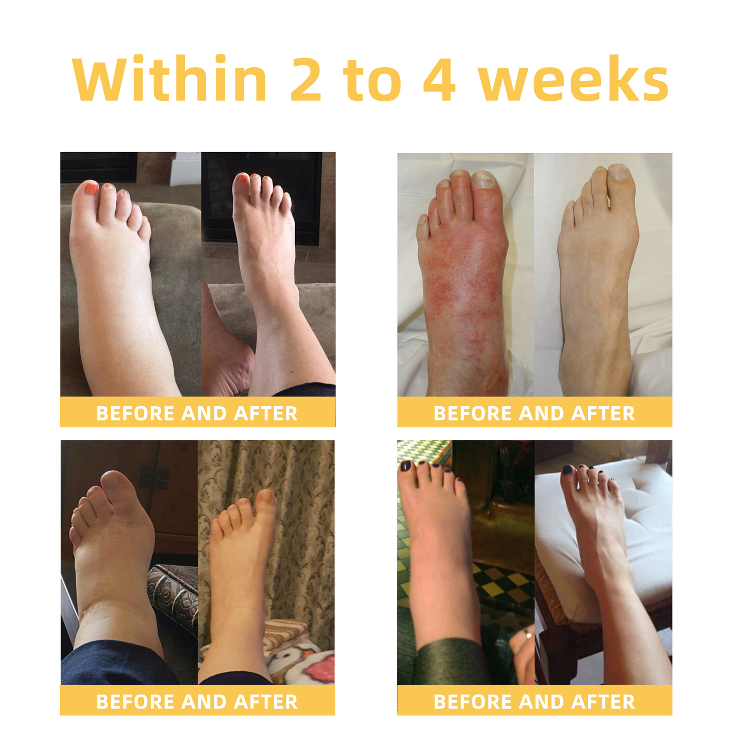 Seurico™ Arthritis and Varicose Vein Treatment Cream