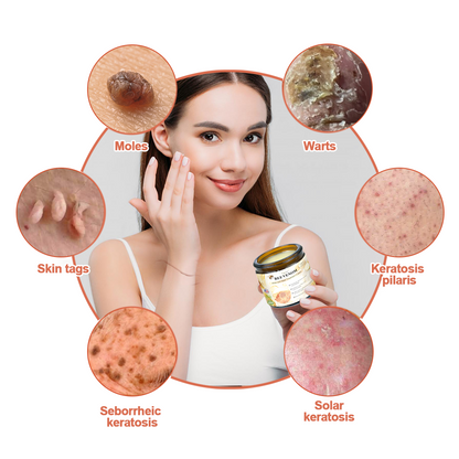 🎄 Holiday Sale Extravaganza: Enjoy 50% Off!  ✨Honeybee Venom Mole and Wart Cream