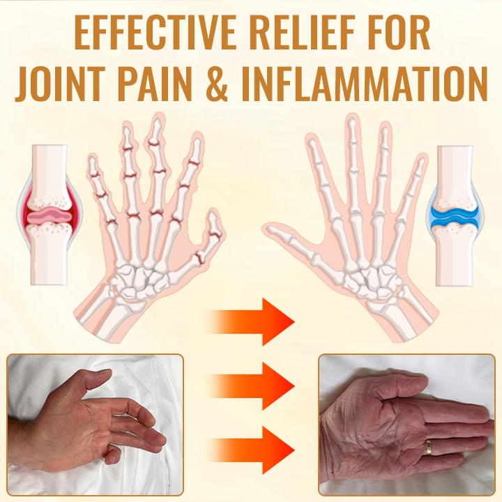 SEURICO Bee Venom Joint and Bone Cream (✨ Specifically designed for orthopedic diseases and joint pain ✨)