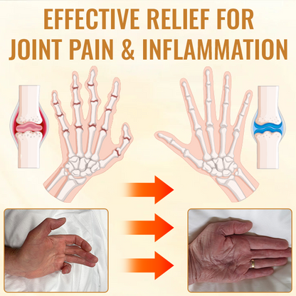 SEURICO Bee Venom Joint and Bone Cream (✨ Specifically designed for orthopedic diseases and joint pain ✨)
