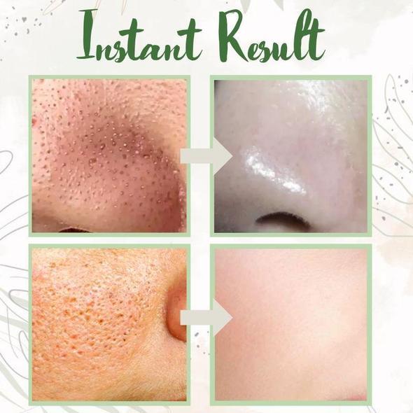 ✨ Green Tea Deep Cleanse Mask