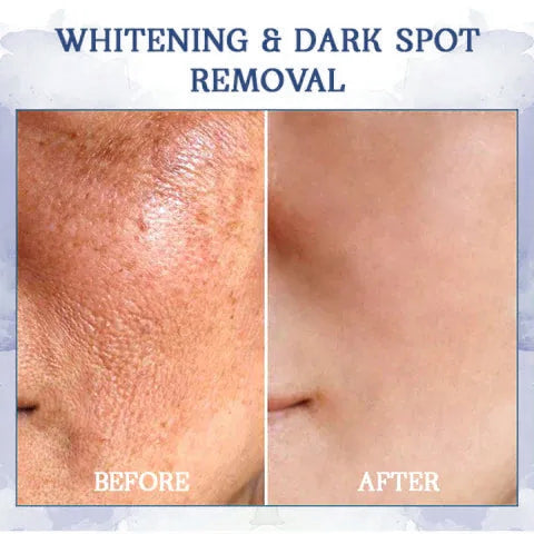 🥥𝐋𝐚𝐬𝐭 𝐃𝐚𝐲 𝐃𝐢𝐬𝐜𝐨𝐮𝐧𝐭: 𝟕5% 𝐎𝐅𝐅🫧 Advanced Fat-Burning & Firming Cream: Eliminate Excess Fat and Restore Skin Elasticity