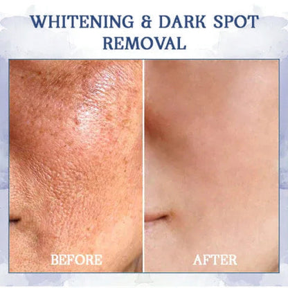 🩵𝐋𝐚𝐬𝐭 𝐃𝐚𝐲 𝐃𝐢𝐬𝐜𝐨𝐮𝐧𝐭: 𝟖𝟕% 𝐎𝐅𝐅🌸𝗝𝗘𝗥𝗘𝗠𝗬𝗧𝗜𝗦™ 𝐀𝐝𝐯𝐚𝐧𝐜𝐞𝐝 𝐅𝐢𝐫𝐦𝐢𝐧𝐠 & 𝐖𝐫𝐢𝐧𝐤𝐥𝐞-𝐑𝐞𝐝𝐮𝐜𝐢𝐧𝐠 𝐂𝐫𝐞𝐚𝐦: 𝗥𝗲𝘀𝘁𝗼𝗿𝗲 𝗦𝗸𝗶𝗻 𝗘𝗹𝗮𝘀𝘁𝗶𝗰𝗶𝘁𝘆⭐
