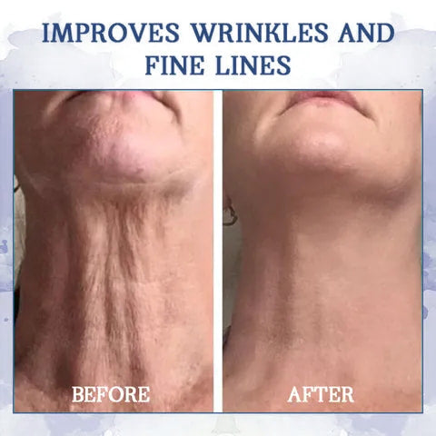🥥𝐋𝐚𝐬𝐭 𝐃𝐚𝐲 𝐃𝐢𝐬𝐜𝐨𝐮𝐧𝐭: 𝟕5% 𝐎𝐅𝐅🫧 Advanced Fat-Burning & Firming Cream: Eliminate Excess Fat and Restore Skin Elasticity