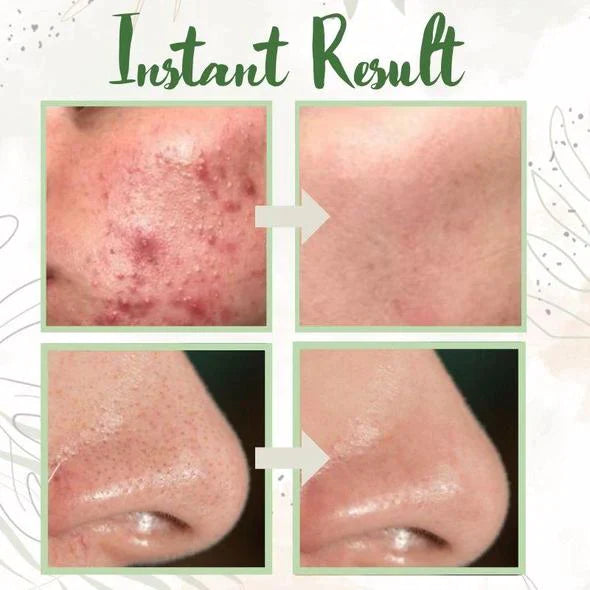 ✨ Green Tea Deep Cleanse Mask