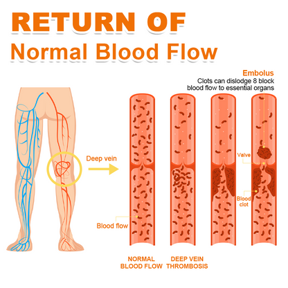 Seurico™ Arthritis and Varicose Vein Treatment Cream