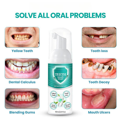 🌿NEW TEETH Mouthwash Foam - Solve All Oral Problems 🔥 LAST DAY SALE 70% OFF 🔥