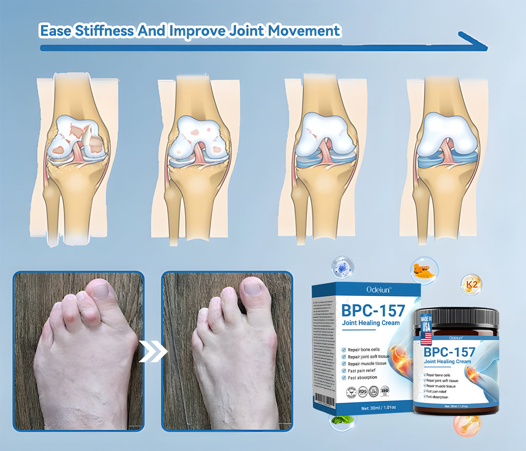 Advanced Relief: ODEIUN™ BPC-157 Joint Healing Cream🦴Treats Arthritis. Neuropathy. Rheumatism. Sports Injuries & More🦵