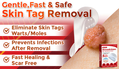 ✅Negusy™ MicroNeedle Botanic Skin Tag Removal Patches – 🇺🇸 Made in the USA | Fast, Painless, Plant-Powered