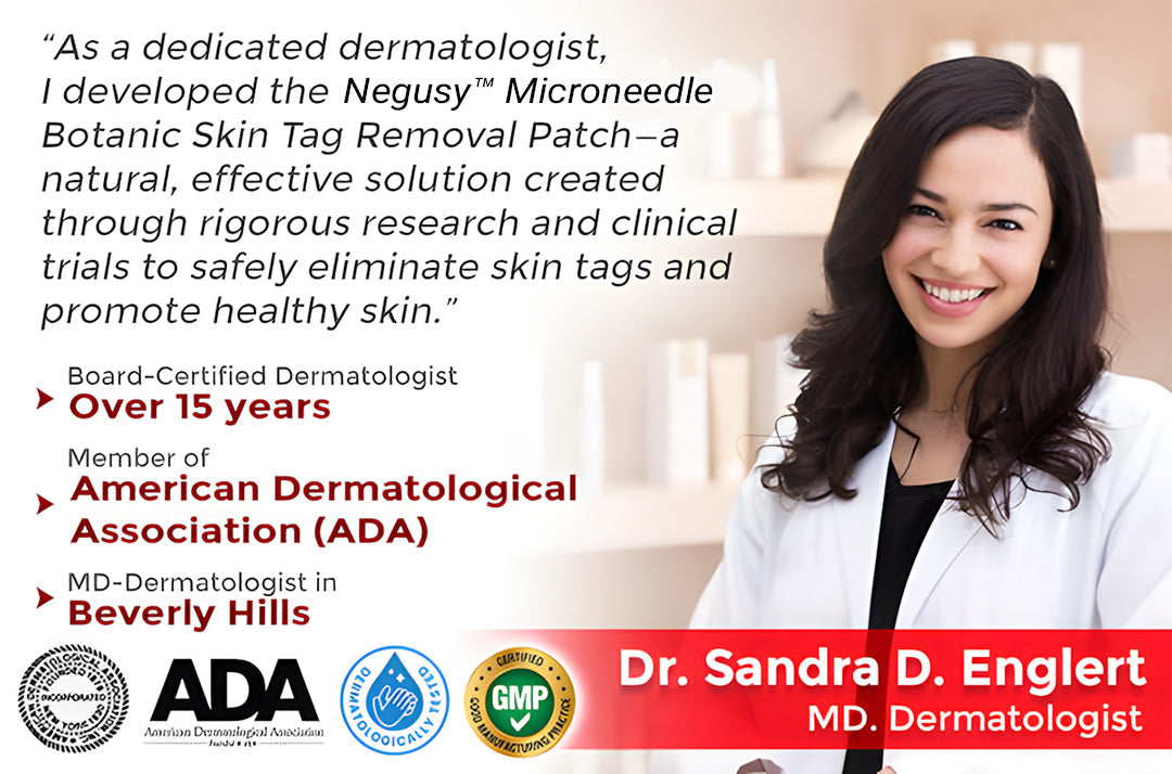 ✅Negusy™ MicroNeedle Botanic Skin Tag Removal Patches – 🇺🇸 Made in the USA | Fast, Painless, Plant-Powered