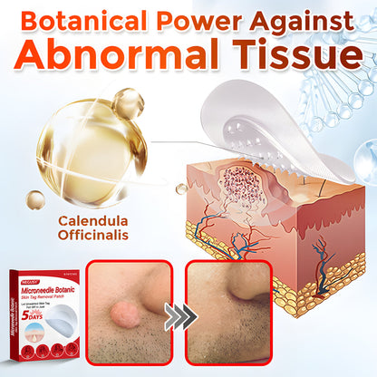 ✅Negusy™ MicroNeedle Botanic Skin Tag Removal Patches – 🇺🇸 Made in the USA | Fast, Painless, Plant-Powered