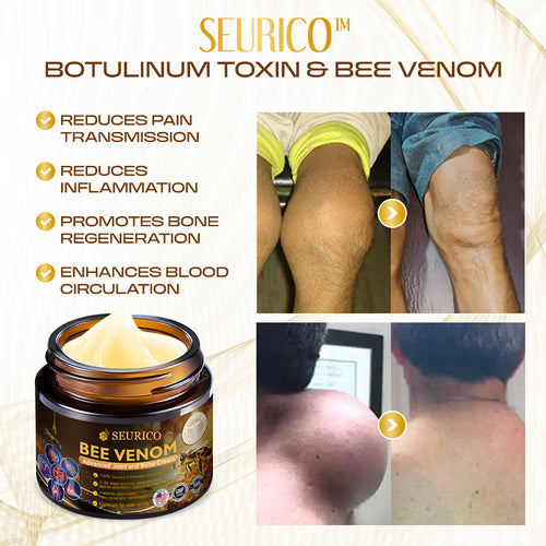 💪 Experience Natural Pain Relief and Enhanced Mobility with Seurico™ Bee Venom Therapy