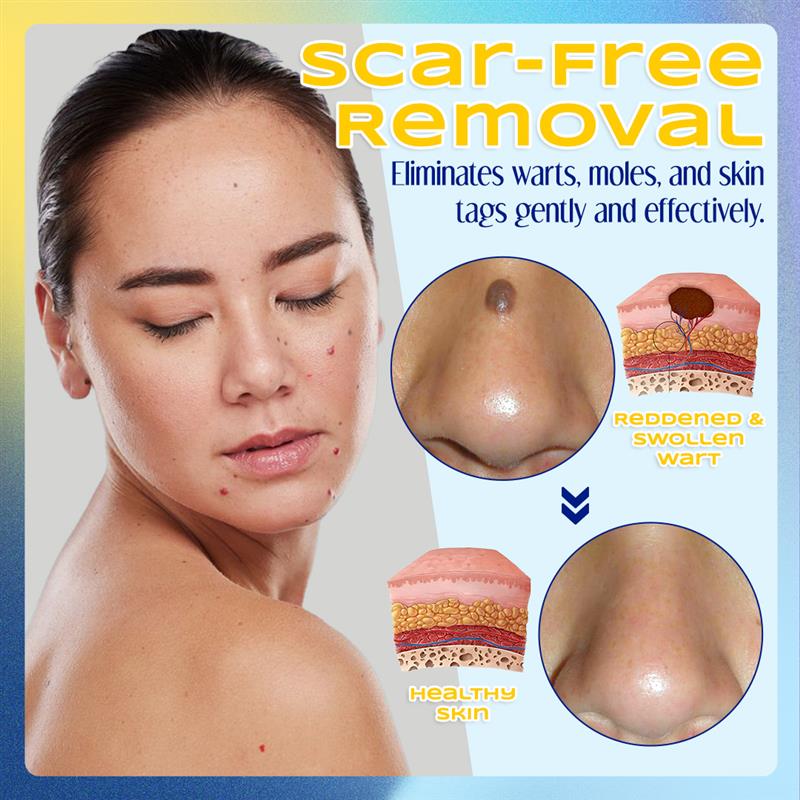 ✨ ODEIUN™ Nevus Removal Cream – Fade Moles & Dark Spots for Clear, Radiant Skin 🌿💧