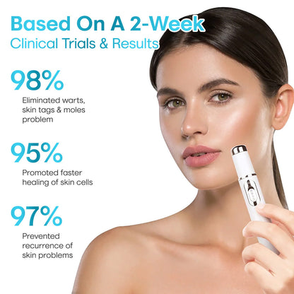 Seurico™ Laser Pen – Non-Invasive Mole and Wart Removal 1–3 days