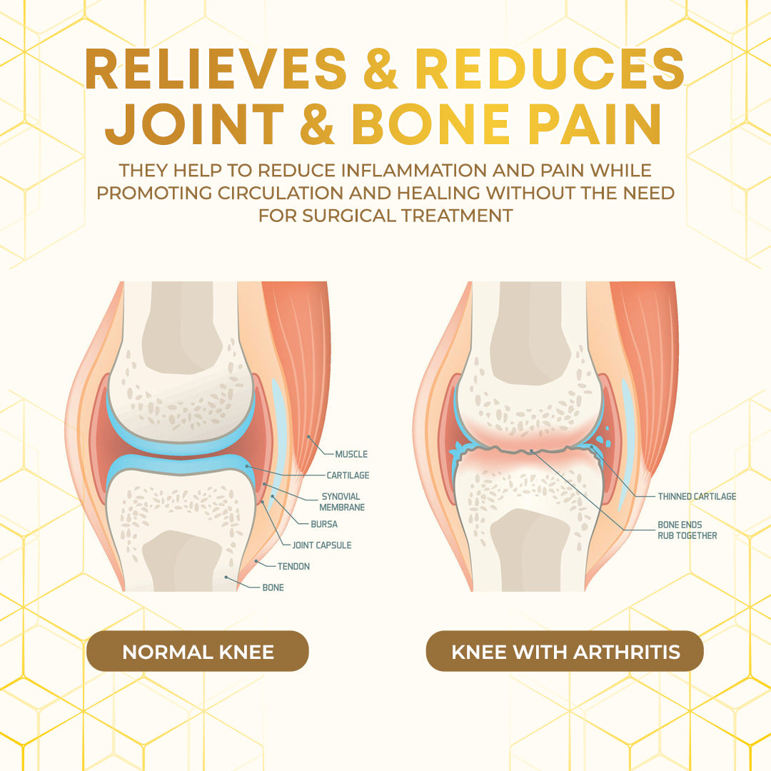 Seurico™  Bee Venom Joint Therapy Pain Relief Gel🐝🔥
