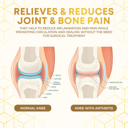 Seurico™  Bee Venom Joint Therapy Pain Relief Gel🐝🔥