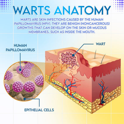 ✨🌿 ODEIUN™ HPV Genital Warts Relief Cream – Fast, Gentle & Private Care 💪