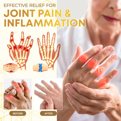 Seurico™  Bee Venom Joint Therapy Pain Relief Gel🐝🔥