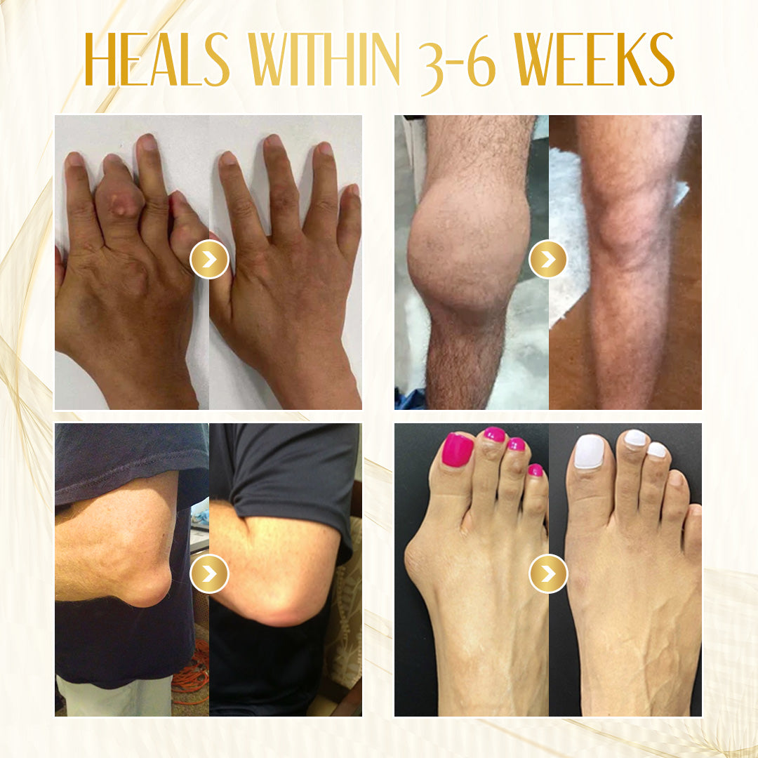 💪 Experience Natural Pain Relief and Enhanced Mobility with Seurico™ Bee Venom Therapy