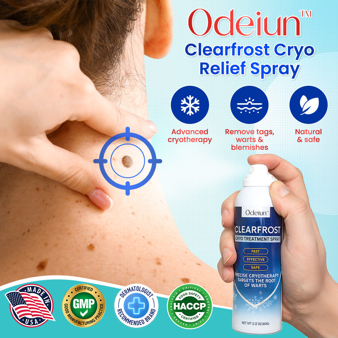 Odeiun™ Clearfrost Cryo Relief Spray🔥 – Advanced Wart & Skin Tag Removal Solution