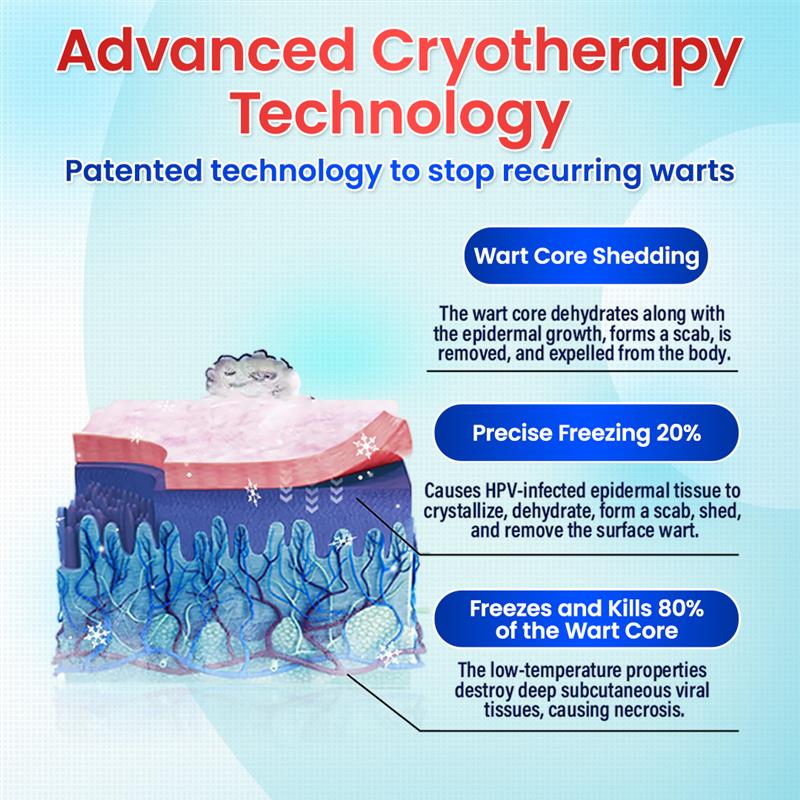 Odeiun™ Clearfrost Cryo Relief Spray🔥 – Advanced Wart & Skin Tag Removal Solution