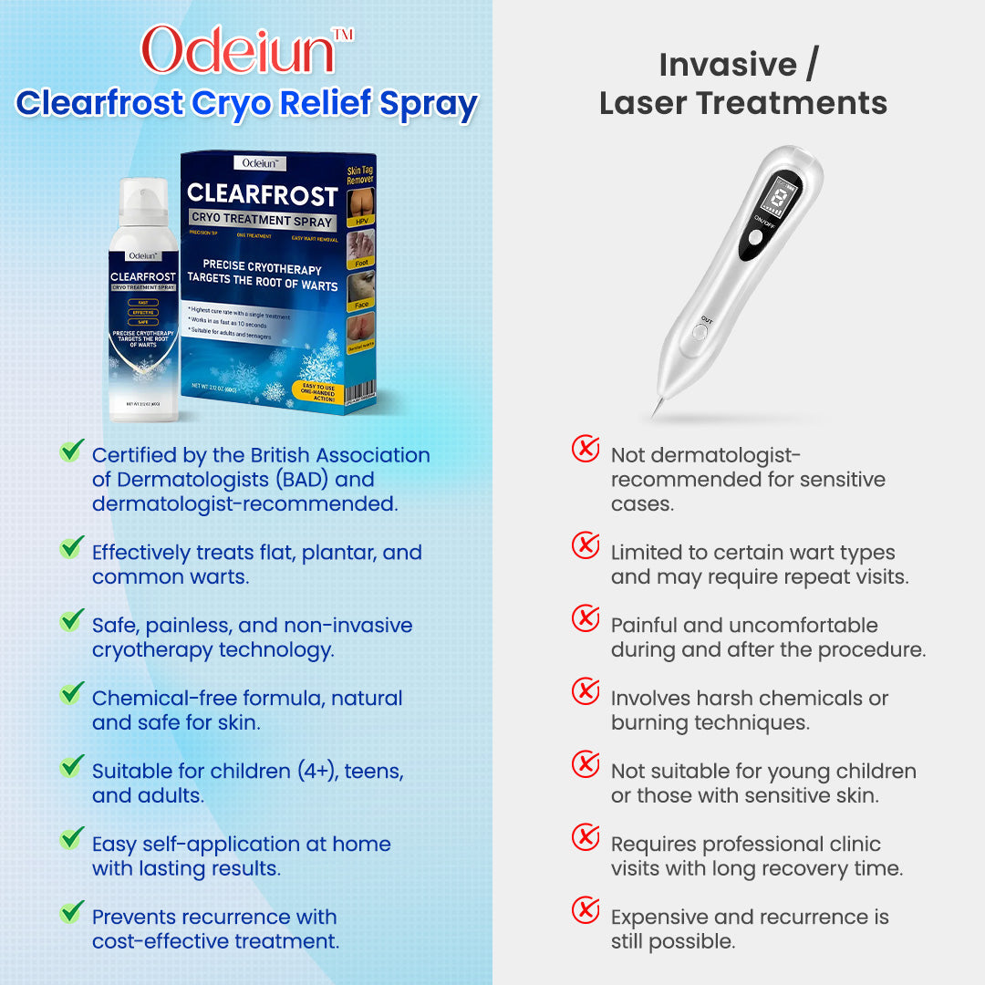 Odeiun™ Clearfrost Cryo Relief Spray🔥 – Advanced Wart & Skin Tag Removal Solution
