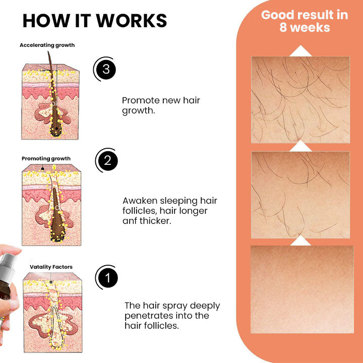 Seurico™ Ashwagandha 4500 Hair Growth Spray