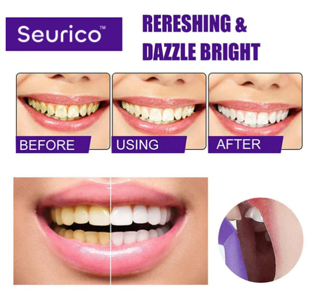 🚨 Clearance Blowout Sale! 🚨 Seurico Herbal Whitening Mousse Toothpaste