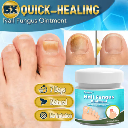 5X Quick-healing Nail Fungus Ointment