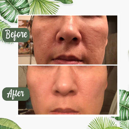 ✨ Green Tea Deep Cleanse Mask
