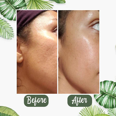 ✨ Green Tea Deep Cleanse Mask