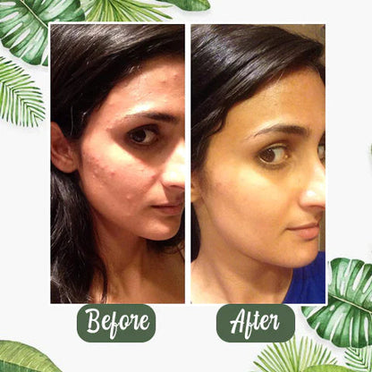✨ Green Tea Deep Cleanse Mask