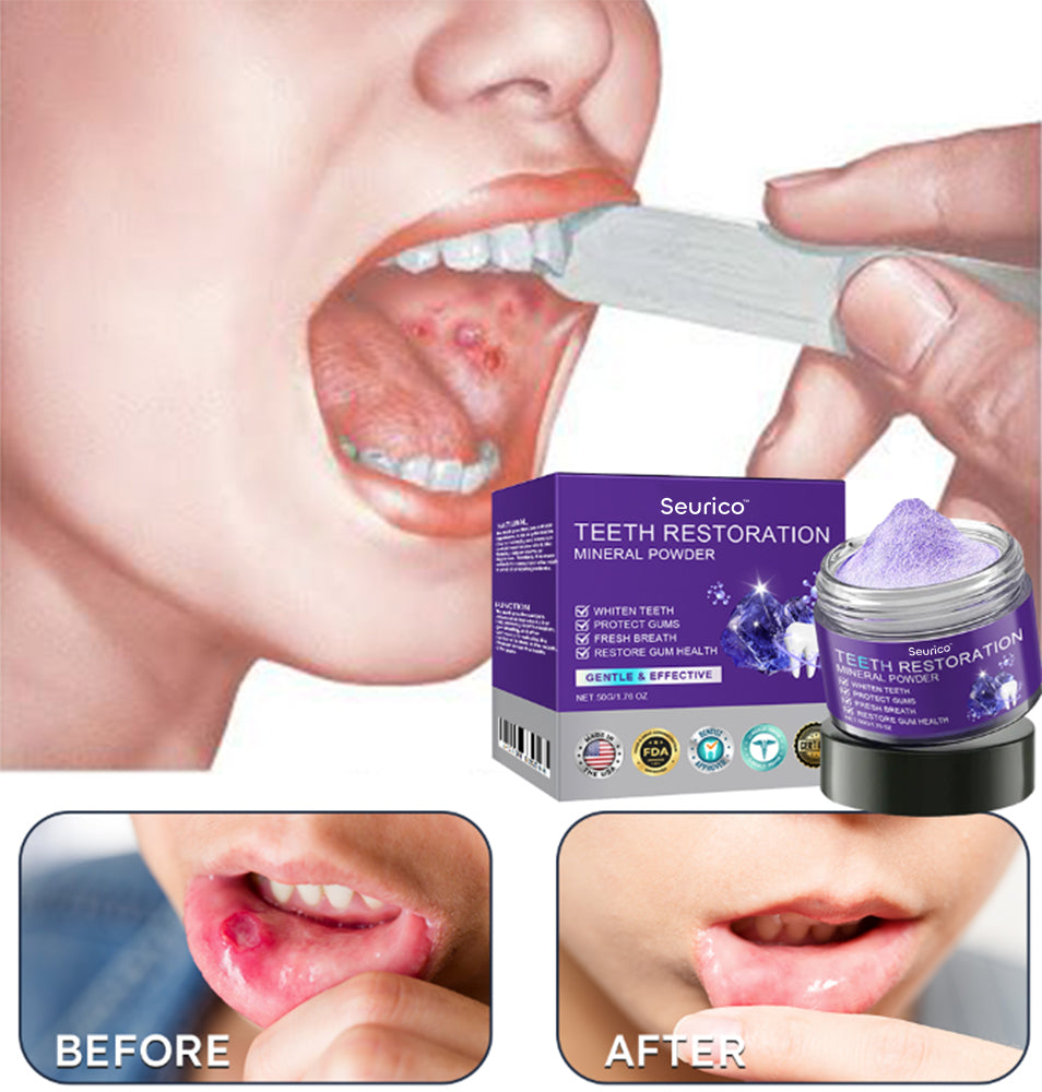Official Store | Seurico™ Tooth Health Mineral Powder - ✅ TGA-Certified 🎁 Flash Sale - Don’t Miss Out !