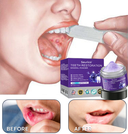 Official Store | Seurico™ Tooth Health Mineral Powder - ✅ TGA-Certified 🎁 Flash Sale - Don’t Miss Out !
