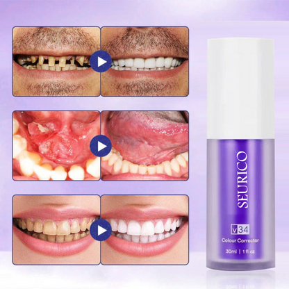 Seurico™ Teeth Whitening Repair Regrowth Dental Gel