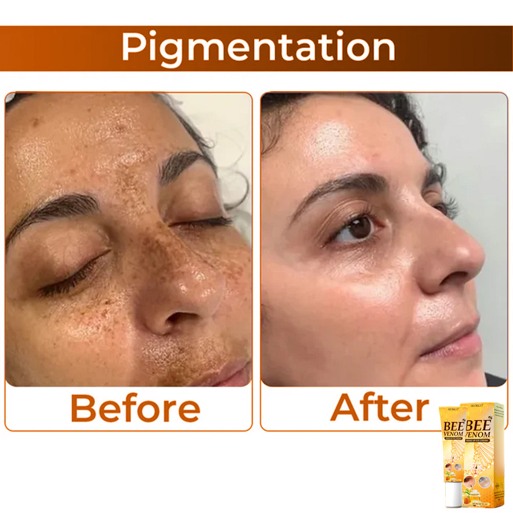 🏆 Seurico™ Collagen+ Bee Venom Anti-Sagging Lifting Wake Up Eye Cream 🐝